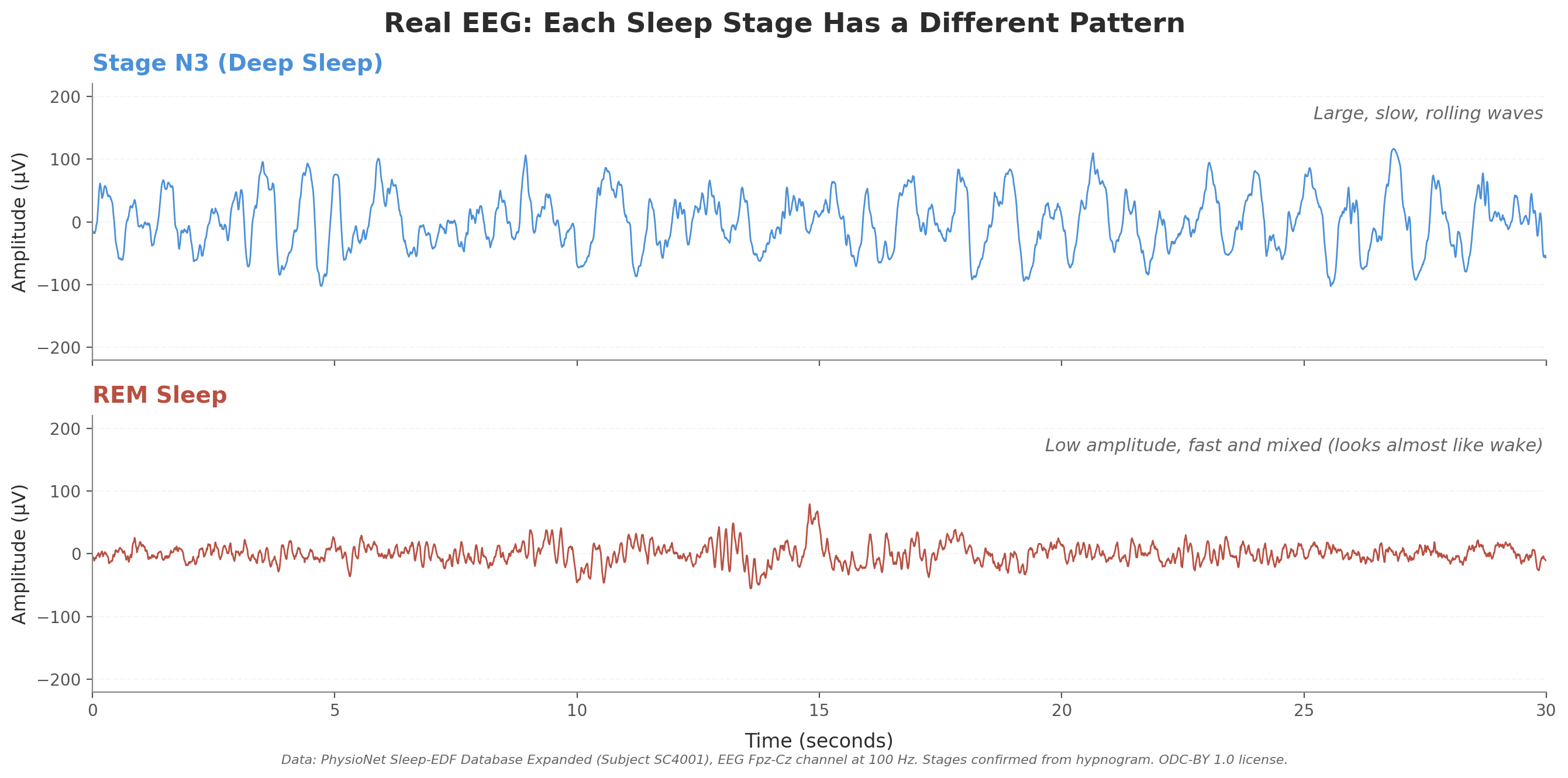 Two stacked EEG traces over 30 seconds. The top trace, labeled Stage N3 (Deep Sleep), shows large irregular slow waves with peaks reaching about 100 microvolts. The bottom trace, labeled REM Sleep, shows low-amplitude fast mixed-frequency activity that visually resembles waking EEG.